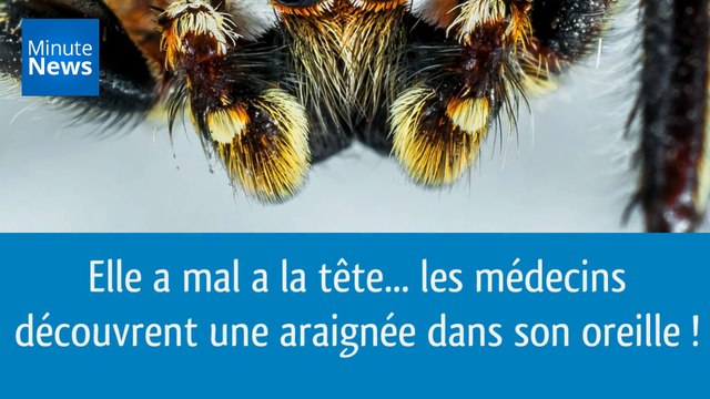 Elle a mal à la tête... Les médecins découvrent une araignée dans son oreille !