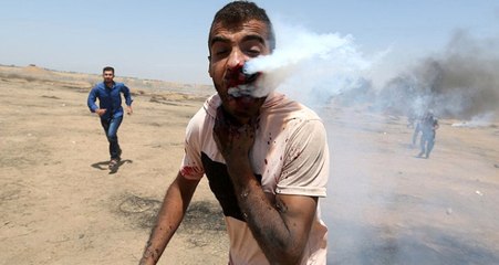 İsrail Askerinin Attığı Gaz Kapsülü Filistinli Gencin Boğazına Saplandı