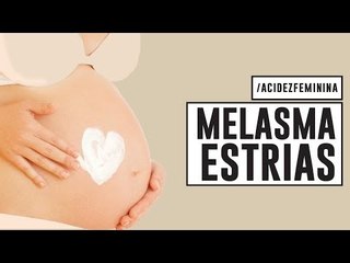 CUIDADOS com a PELE na GRAVIDEZ | MELASMA, ESTRIAS, ACNE, VARIZES com Dra Cintia Cunha