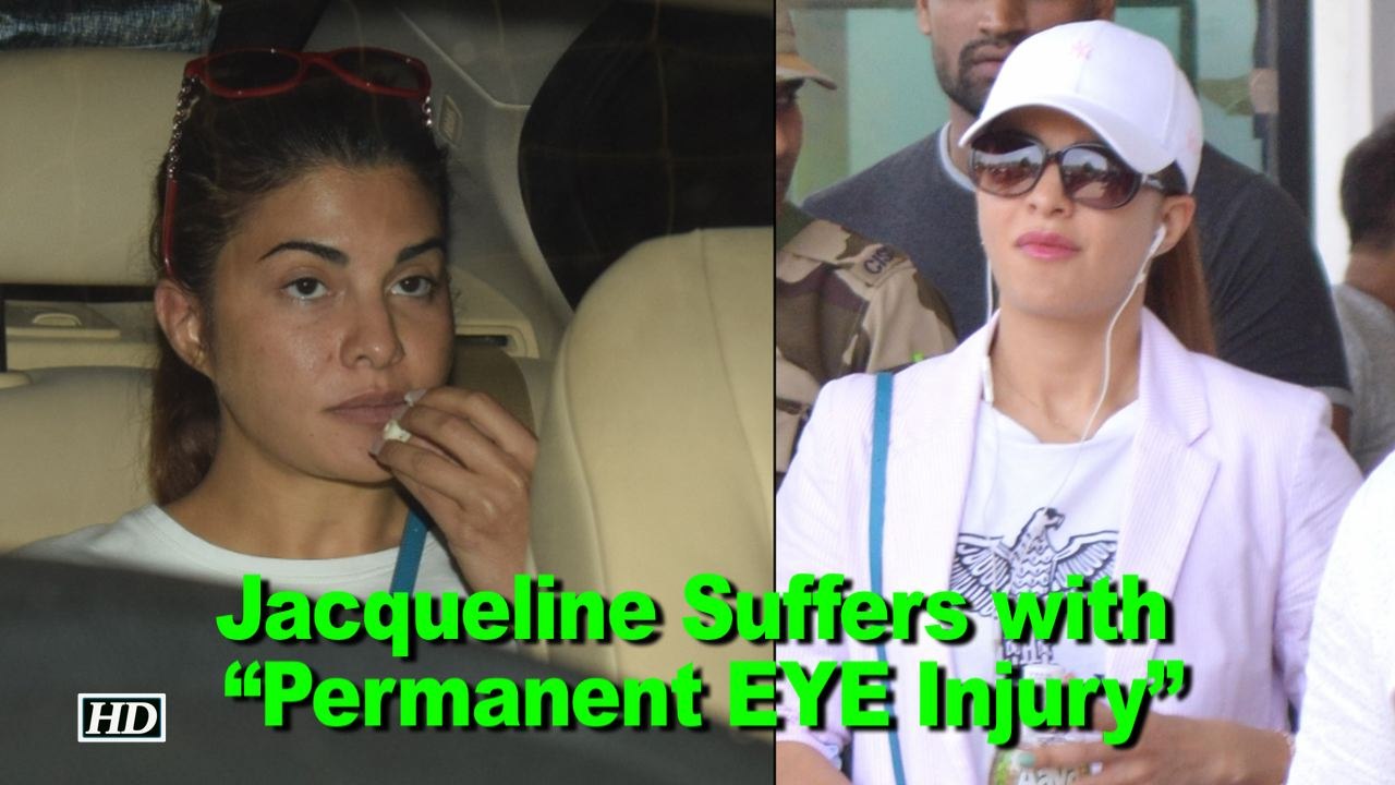 Jacqueline Fernandez Suffers with “Permanent EYE Injury”