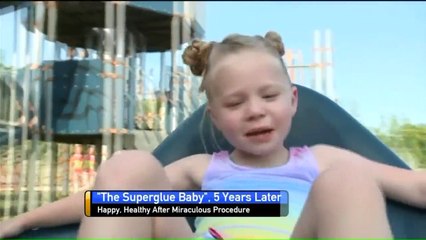 Baby Saved from Aneurysm With Super Glue Now a Healthy, Happy 5-Year-Old