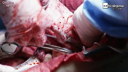 الدم الحلقة 2 - موقع هاي دراما