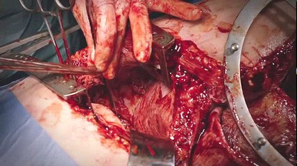 Holby City S20E24 June 12 , 2018