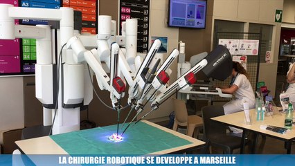 La minute Santé : La chirurgie robotique se développe à Marseille