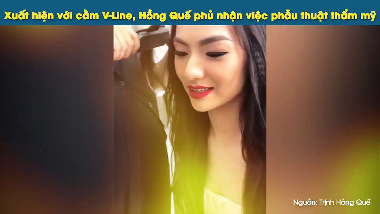 Xuất hiện với cằm V-Line, Hồng Quế phủ nhận việc phẫu thuật thẩm mỹ