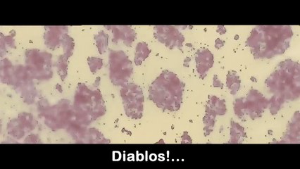 Diablos!