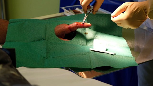 La vie après les urgences à la polyclinique Thur-Doller