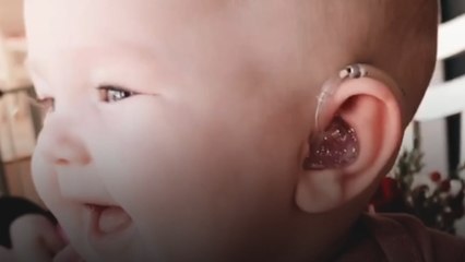 This Baby Just Received Hearing Aids For The First Time