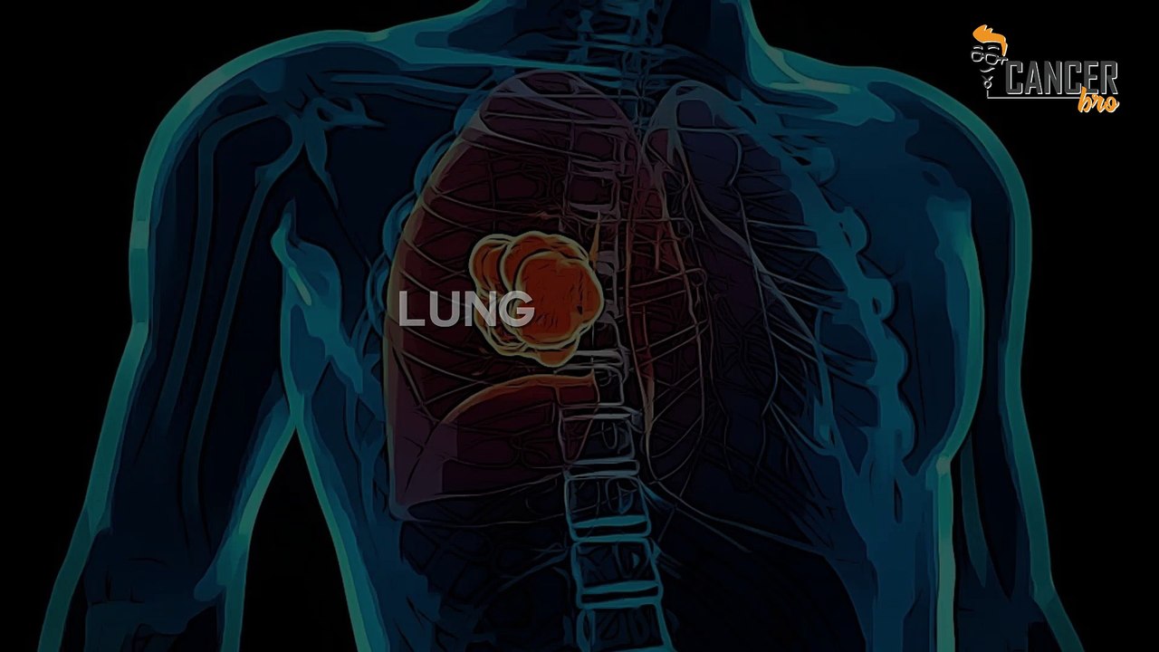 Different types of cancer caused by smoking