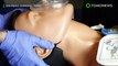 Kasus medis aneh: pasien terbangun selama CPR 90 menit - TomoNews