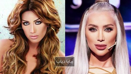 10 نجمات عربيّات قبل وبعد عمليّة نفخ الشفاه: صور صادمة وتغيّر جذريّ مبالغ به!