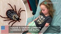 Gadis lumpuh karena gigitan kutu! - TomoNews