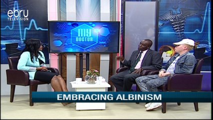Conditions People Living With Albinism  Are At A Risk Of Getting