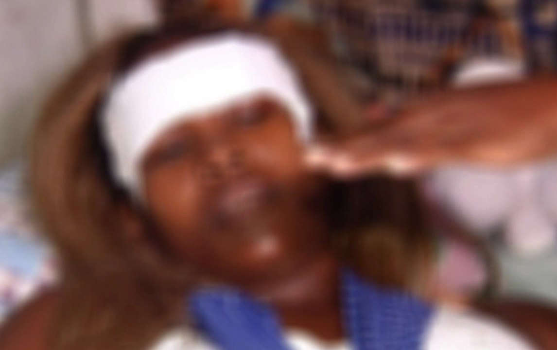 Guayaquil: violento ataque a una mujer con una botella se registró mientras las víctima fue a la casa de su comadre