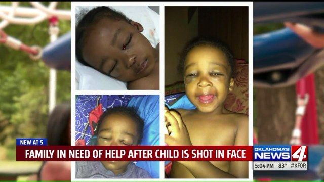 Oklahoma Boy Seriously Injured After Cousin Accidentally Shot Him in Face with Pellet Gun