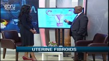 Is It Possible To Prevent Uterine Fibroids