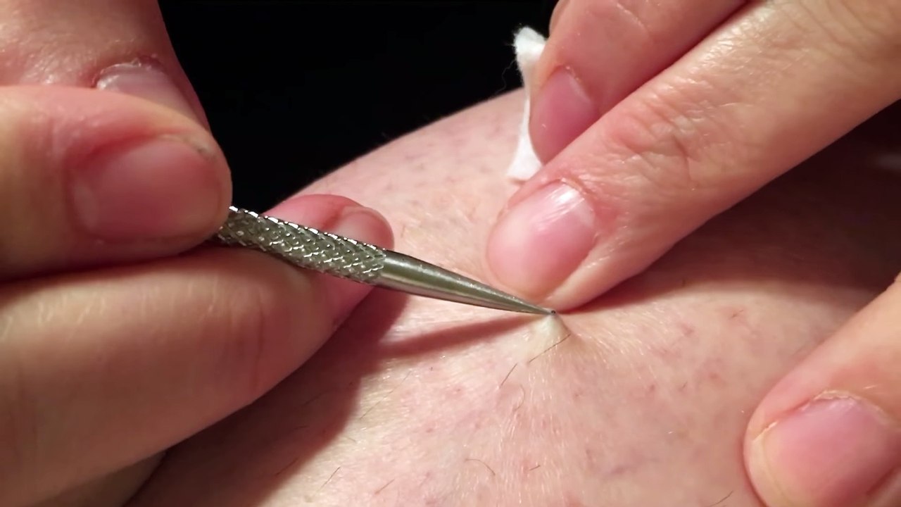 Pulling out Three Year Old Stitch