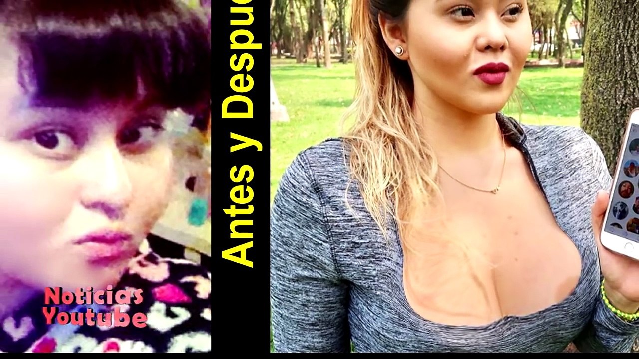 La evolución de Gomita antes y después de sus cirugías