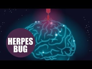 Alzheimer's 'may be caused by a virus'