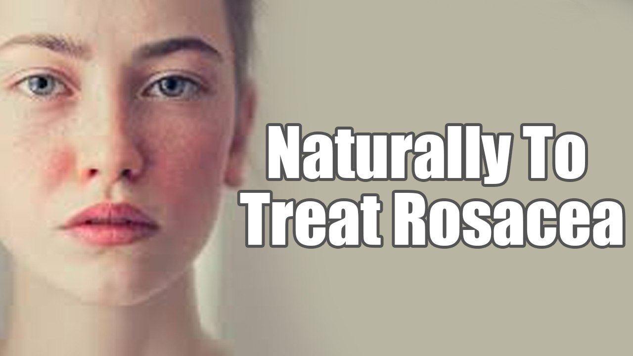 7 Remedies You Can Use To Naturally Treat Rosacea | Boldsky