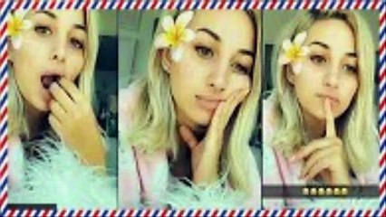 مودل روز تصاب بنتفاخ في خدها وترفض إجراء العملية