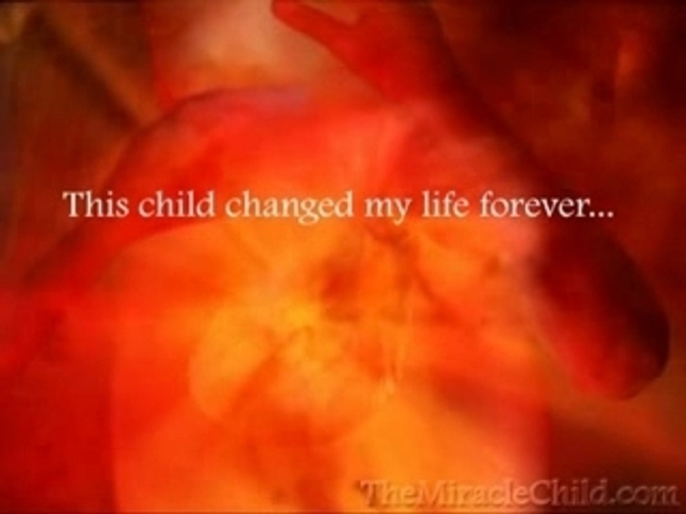 The Miracle Child