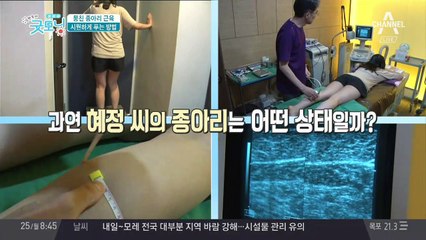 뭉친 '종아리 알' 없애는 방법! 전문가의 팁은?