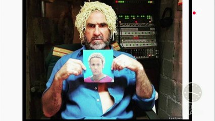 Accident capillaire dans la coupe du monde !