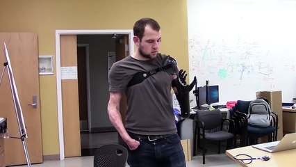 Avec cette prothèse, les gens retrouvent le sens du toucher et même la douleur