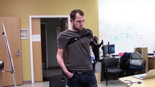 Avec cette prothèse, les gens retrouvent le sens du toucher et même la douleur