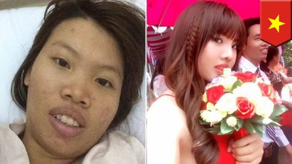 整形手術で自信と結婚相手を手に入れたベトナム人女性 - トモニュース