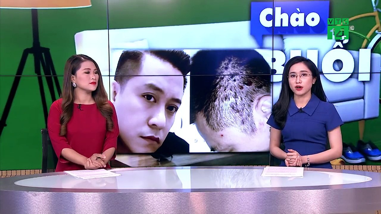 Căn bệnh khiến ca sỹ Tuấn Hưng phát điên khó chữa tới mức nào- - VTC News