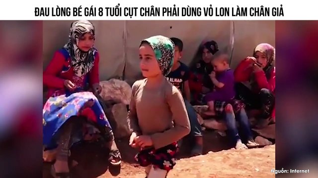 ĐAU LÒNG BÉ GÁI 8 TUỔI CỤT CHÂN PHẢI DÙNG VỎ LON LÀM CHÂN GIẢ