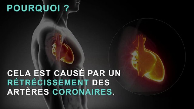 Angine de poitrine : les 3 premiers signes