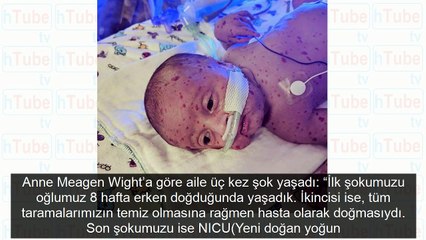 Doktorları bile hayrete düşürdü görenler korkup kaçıyor ama...