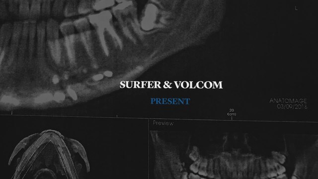 The Inspiring Story of Dusty Payne's Return to Surfing | Relentless: A SURFER Magazine Profile Film