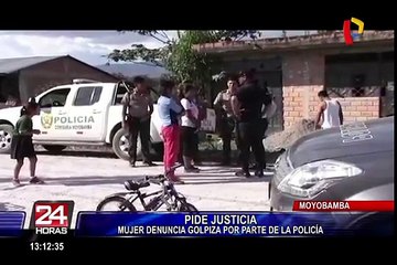 Moyobamba: mujer denuncia agresión por parte de agentes de la policía