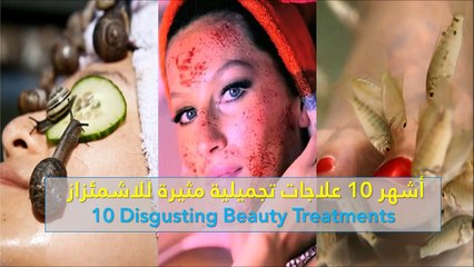 فيديو أشهر 10 علاجات تجميلية في العالم مثيرة للاشمئزاز