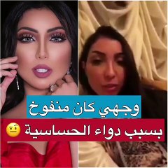تعليق دنيا بطمة على انتفاخ وجهها