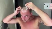 فيديو طريقة وضع وصلات شعر للشباب