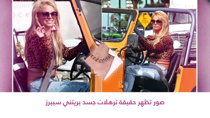 لقطات محرجة تكشف فشل المشاهير في الظهور بأجمل صورة