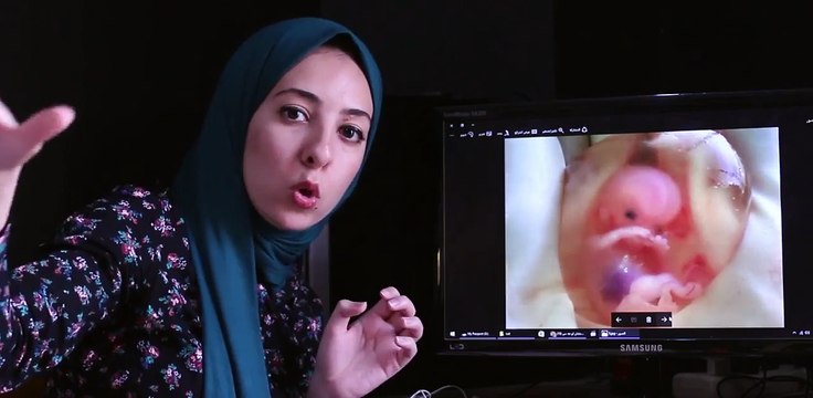 هذا هو سر صورة الجنين الذي خرج وهو ممسك بوسيلة منع الحمل