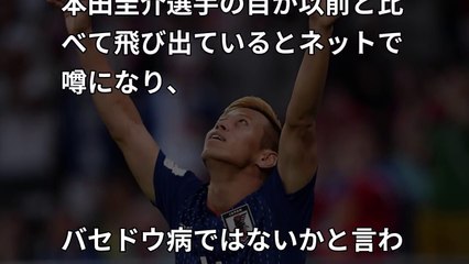 セネガル戦でバレた本田圭佑の"ある重病"に涙が止まらない！ロシアW杯でシセ監督が敬礼に感動した【erika】