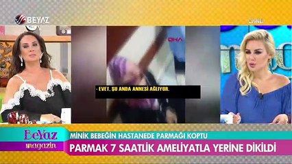 Minik bebeğin, hastanede parmağı koptu