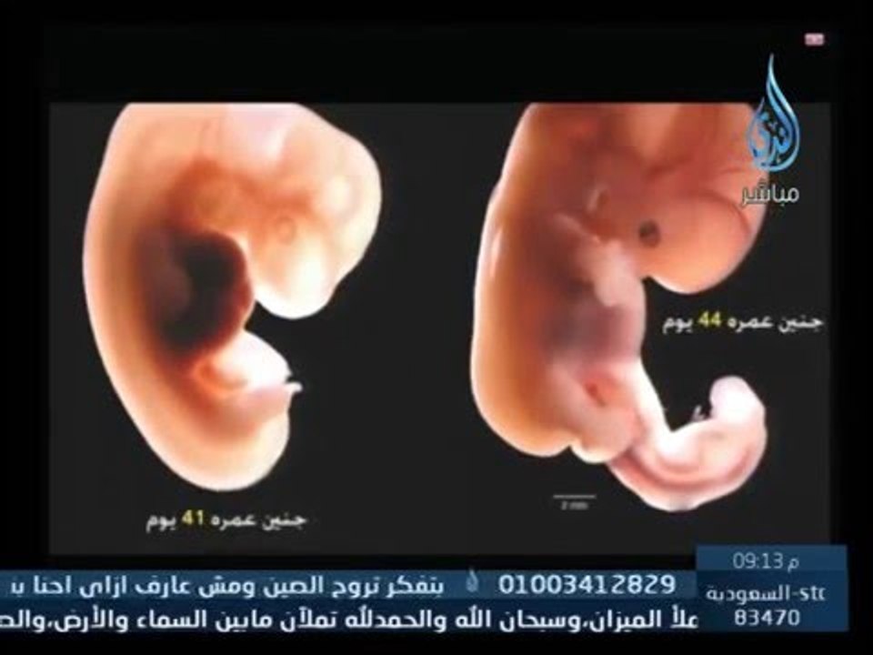 الإعجاز العلمي في أحاديث نبوية عن تطور الجنين .. تكتشفها التكنولوجيا الحديثة