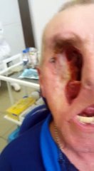 one eye man still alive without tension |amazing man