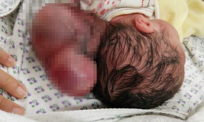 İki kafalı bebek dünyaya geldi