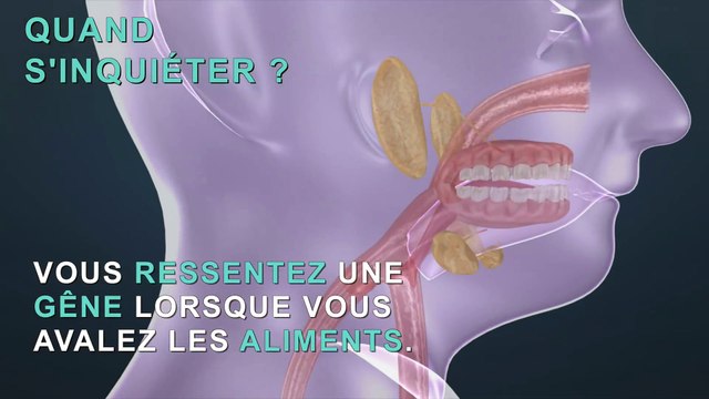 Cancer de la gorge : les premiers symptômes