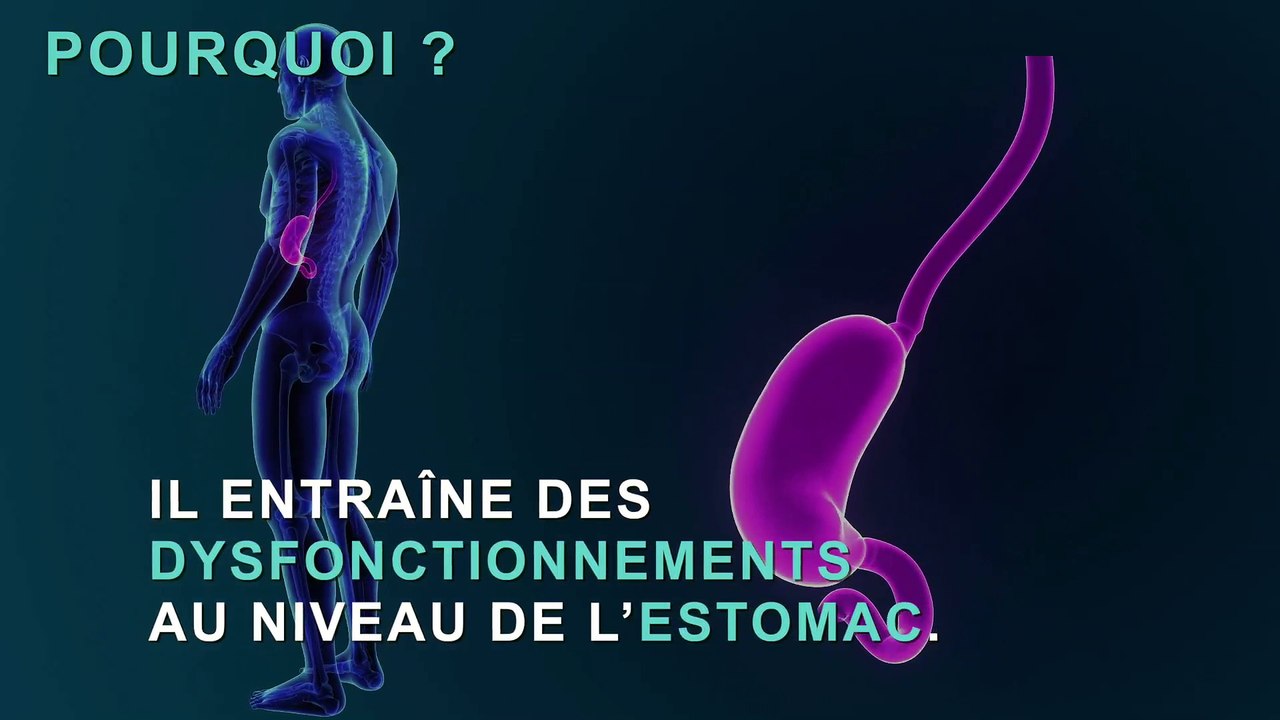 Cancer de l'estomac :  les 3 premiers symptômes