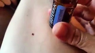 Removing Ticks with Oil